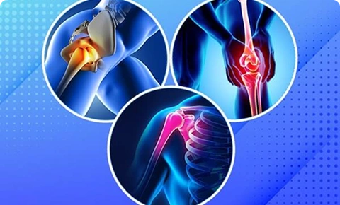 Medical illustration highlighting joint pain in the shoulder, hip, and knee.